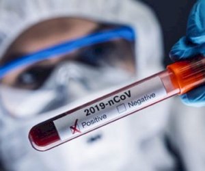    Gürcüstanda koronavirus MƏNZƏRƏSİ: 62 yeni yoluxma   