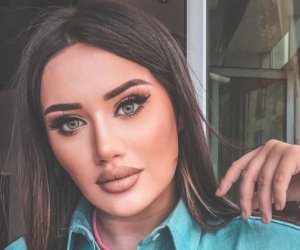   Gecə klubunda olan bloqer Ayselin yaralı halda fotosu   