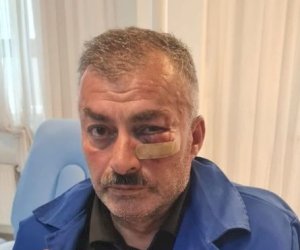    Yaba ilə “Azəriqaz”ın işçilərini hədələdi: Xəsarət alan var - Fotolar   