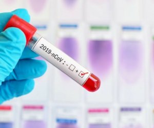    Azərbaycanda koronavirus STATİSTİKASI: Ölən yoxdur   