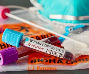    Azərbaycanda koronavirus STATİSTİKASI: 16 yeni yoluxma   