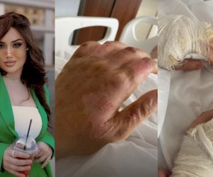    Gecə klubunda yaralanmış Aysel: “Psixoloji müalicə alıram“   