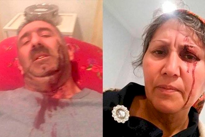    Qaçırılan qızın qohumları oğlanın ata-anasını bıçaqladılar   