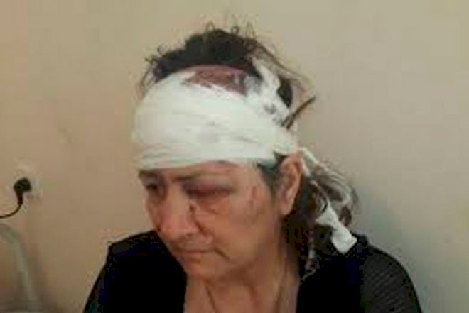    Sumqayıtda kürəkən qayınanasını döyüb   