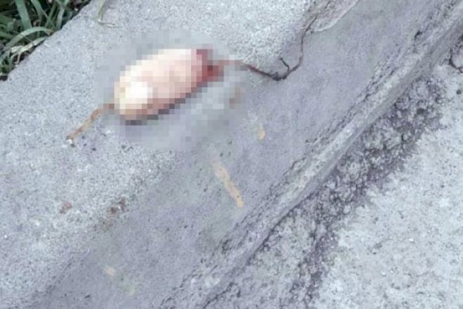    Uşaqlar küçədə kəsilmiş barmaqlar tapdı - Foto   