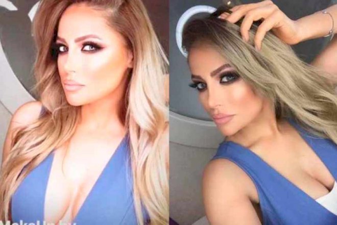    Nigar Camal elə geyindi ki, alt paltarı göründü -   Foto