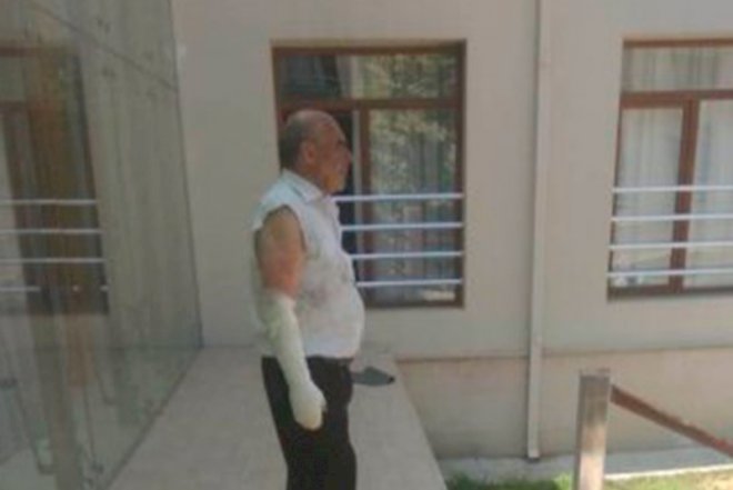    Aprel döyüşçüsünün intiharı ilə bağlı həkim işdən uzaqlaşdırıldı   