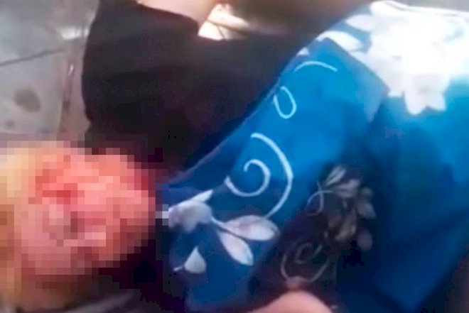    Polis şəhid anasını döyüb?   