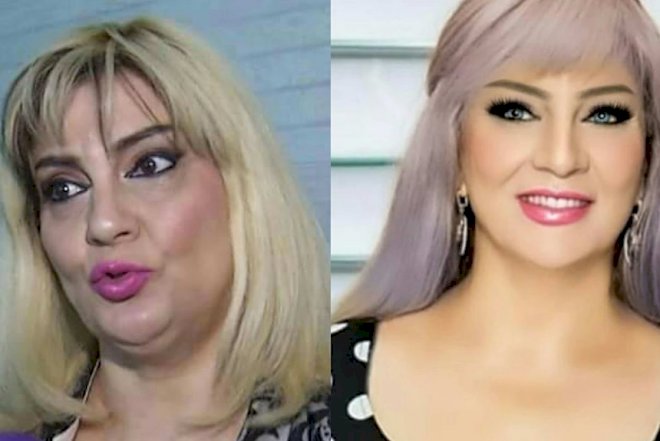    Nüşabə Ələsgərli fotoşopun “ağını çıxardı” - Fotolar   