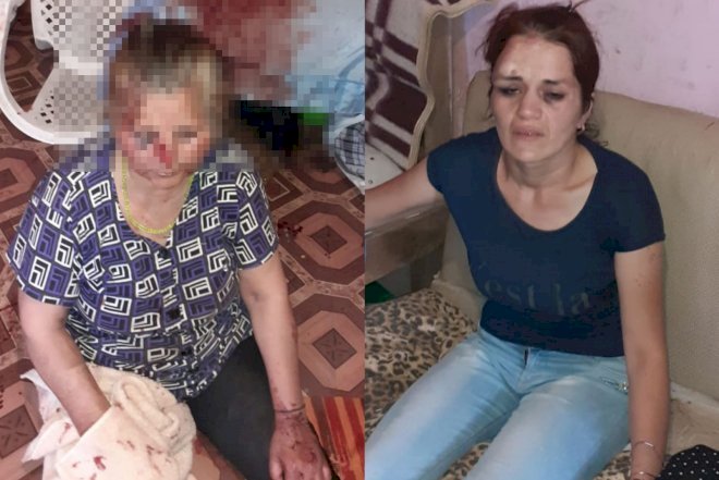    Bakıda yeznə qayınananı qanına qəltan etdi –   Dəhşətli fotolar