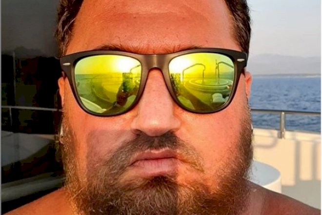    Murad Dadaşov tanınmaz hala düşdü –   Foto