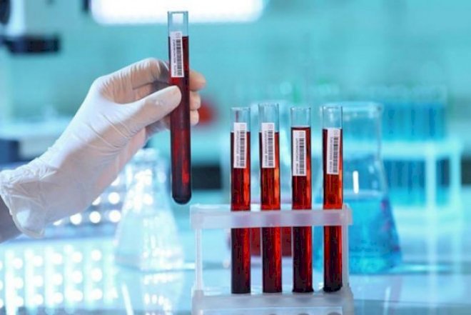    Alimlər ölümü proqnozlaşdıran texnologiya yaratdı   