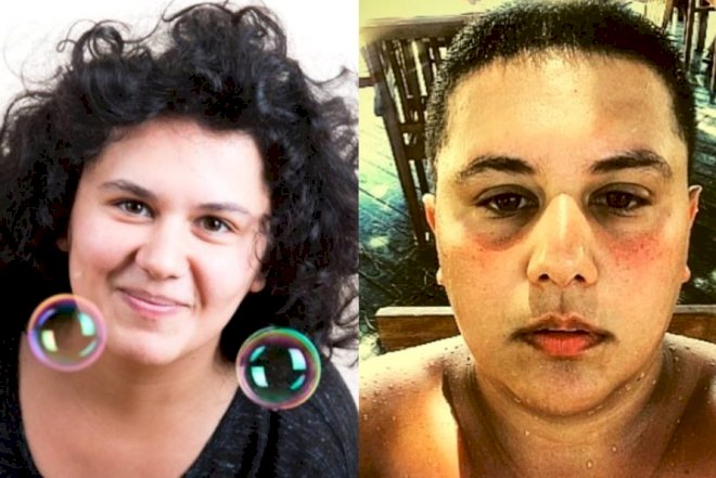    Aktrisa 31 yaşında kişi olmağa qərar verdi, sinəsini kəsdirdi - Fotolar   