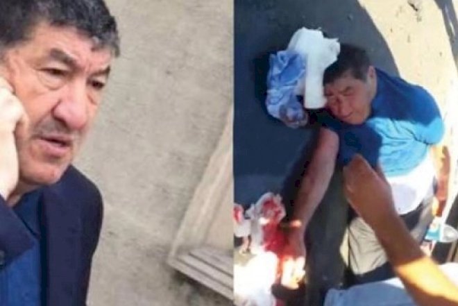    Hacı Mazan Almaniyaya aparıldı   
