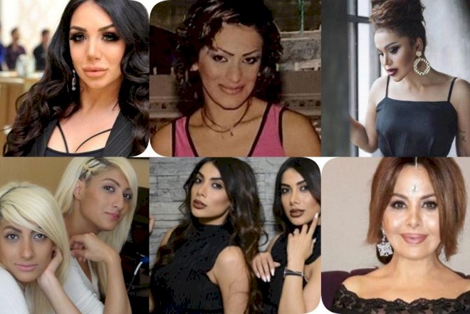    Gözəlliyini estetik əməliyyatlara borclu olan məşhurlarımız - Fotolar   