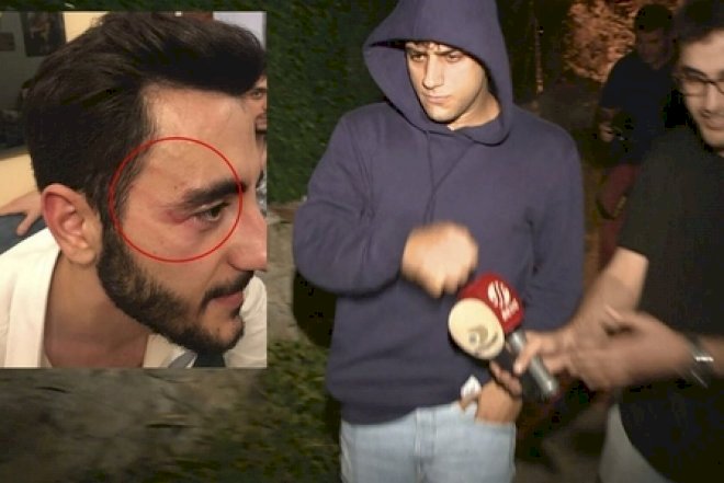    Məşhur müğənni jurnalisti döydü   - Video