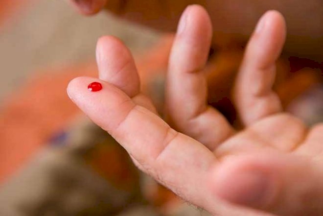    İnsult zamanı nə etmək lazımdır? - Sadə və təsirli üsul   