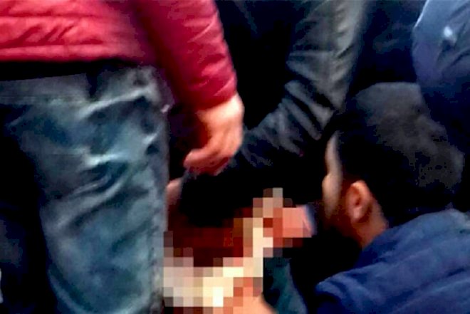    Bakıda qonşular arasında qanlı dava - Bıçaqlanan var   