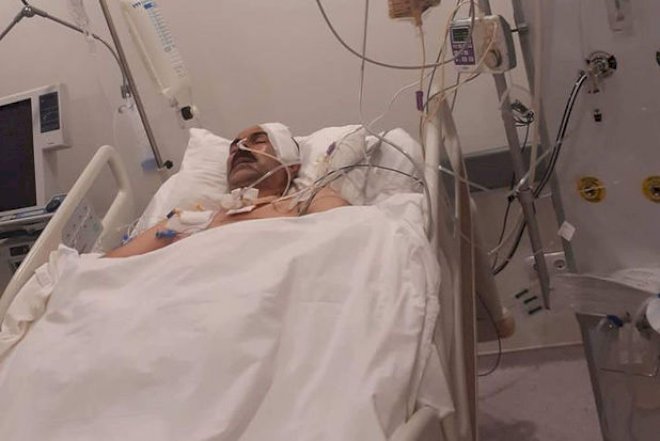    Oqtay Gülalıyevi süni nəfəs aparatından ayırıblar   