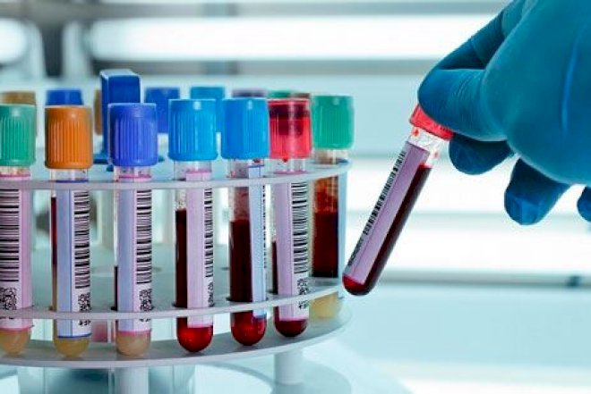    Bizim klinikalarda boşuna təyin olunan analizlər -   Qara siyahı