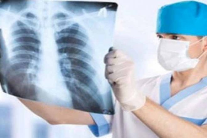    Dünyada 210 milyon adam bu xəstəlikdən əziyyət çəkir   