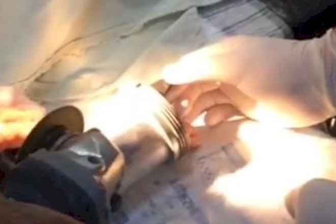    Əli ət maşınında qalan uşaq təcili Xaçmazdan Bakıya göndərildi   