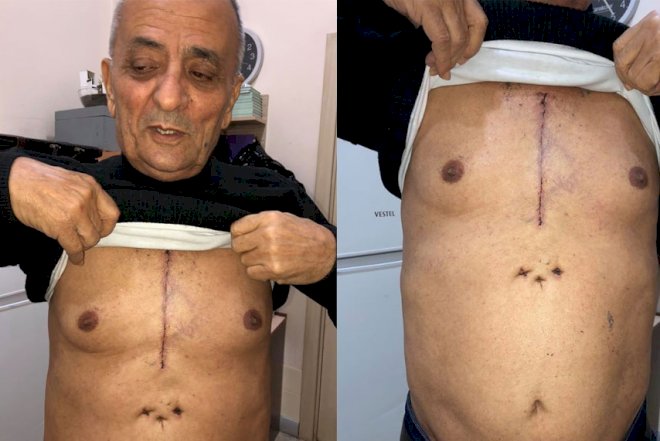    İsgəndər Həmidova nə olub? – Xəstəliyi haqda açıqlama   