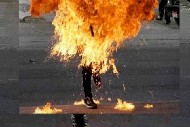    Azərbaycanda polis əməkdaşı özünə od vurdu -   Foto