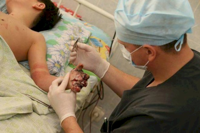    “Zırpaket“ uşağın barmaqlarını qopardı   