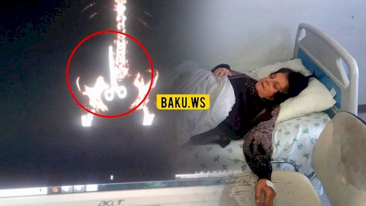    Azərbaycanda həkimlər bunu da etdi:   Qayçını xəstənin bədənində unutdular - Foto