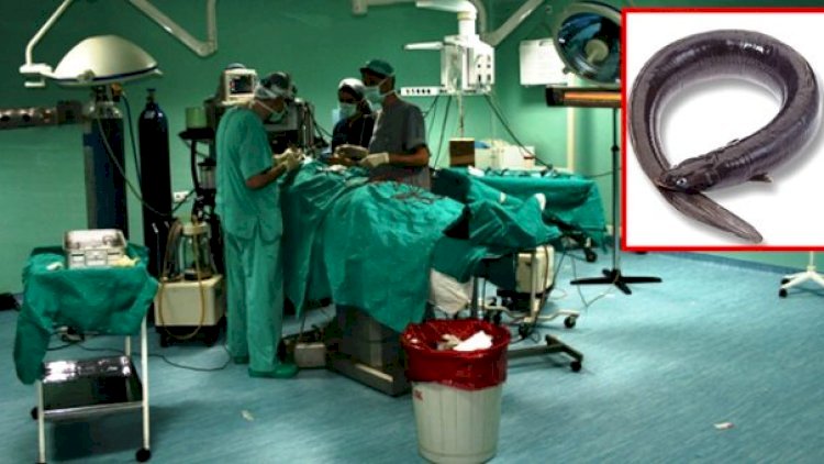    Qəbizlikdən xilas olmaq üçün ilan balığı uddu, ölümdən döndü   
