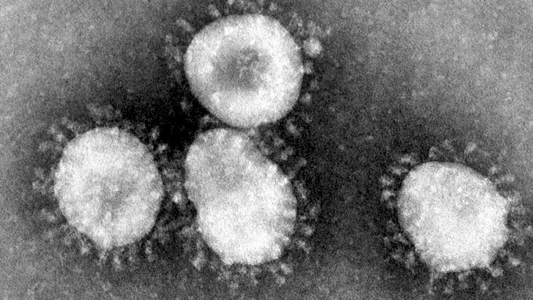    Koronavirus ərəb ölkəsinə də çatdı   