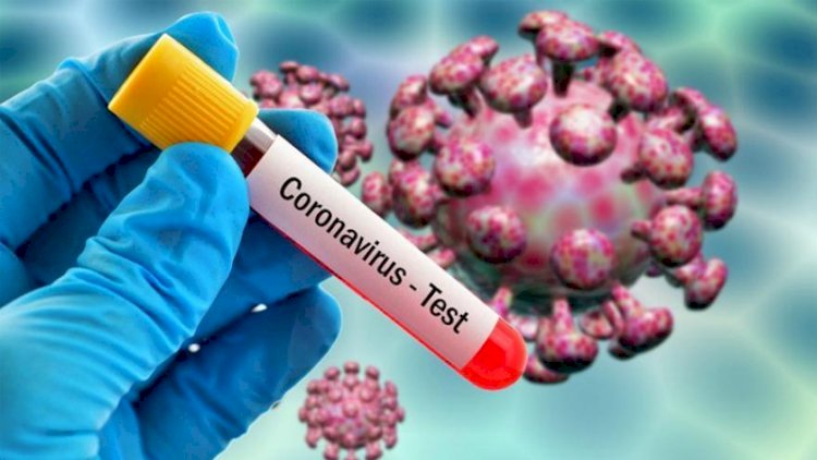    Koronavirusu 8-15 dəqiqəyə aşkarlayan test hazırlandı   