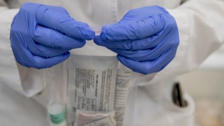    Koronavirusla bağlı “Semaşko”da neçə nəfər qalır?   