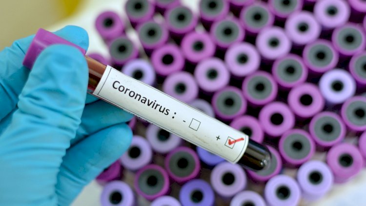    Koronavirus vaksini insanlar üzərində sınaqdan keçiriləcək   