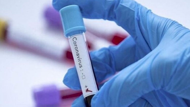    Koronavirus təşvişindən necə xilas olmalı? – Məsləhətlər   