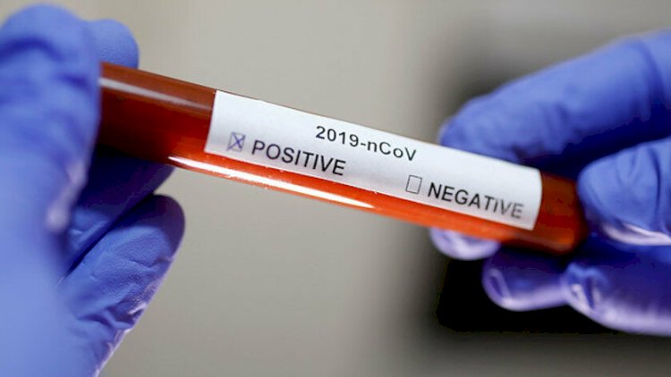    Azərbaycanda daha iki nəfərdə koronavirus tapıldı -   RƏSMİ