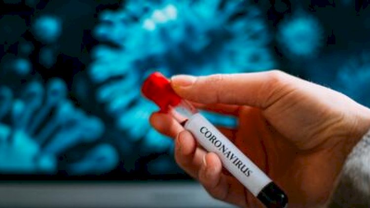    Türkiyədə bir gündə 29 nəfərdə koronavirus aşkarlandı   