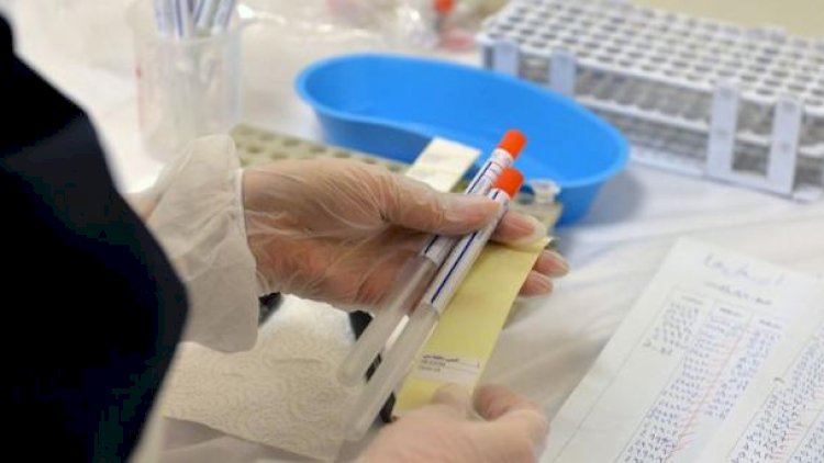    Rusiyada daha 21 nəfərdə koronavirus aşkarlandı   