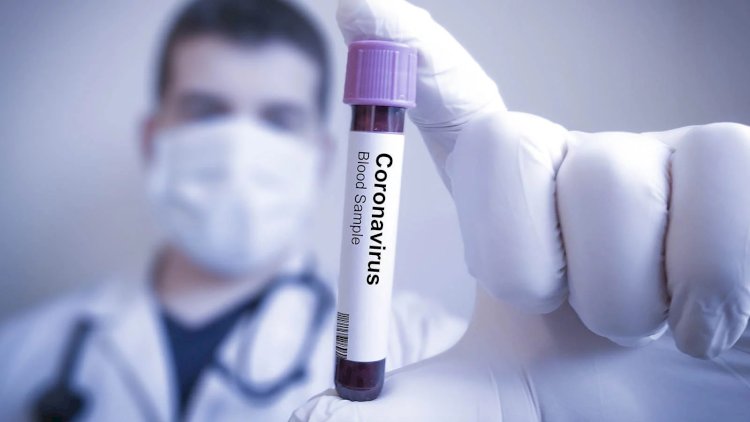    Azərbaycanda daha 10 nəfərdə koronavirus aşkarlandı   