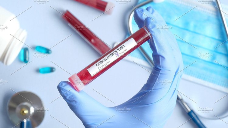    SON DƏQİQƏ: Azərbaycanda daha 43 nəfərdə koronavirus tapıldı -   RƏSMİ