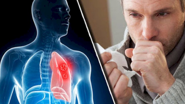    Koronavirus zamanı immuniteti və ağciyəri möhkəmləndirmək üçün   RESEPT