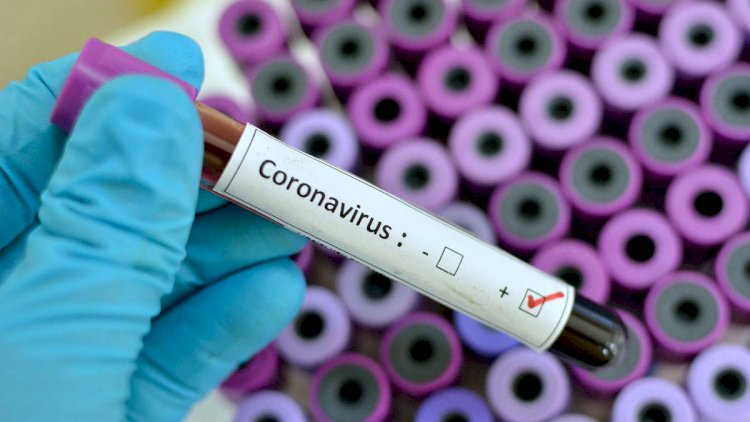    Azərbaycanda koronavirus bu tarixdə məhv olacaq? - Professor danışdı   