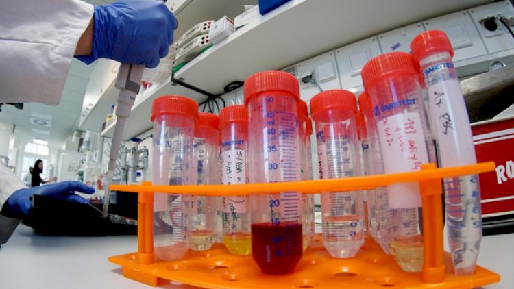    Azərbaycanda son bir gündə 64 nəfərdə koronavirus aşkarlanıb   