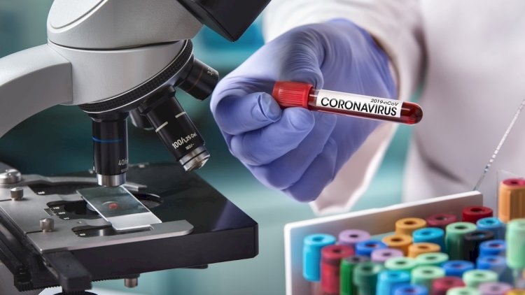    Azərbaycanda daha 43 nəfərdə koronavirus aşkarlandı -   Xəstələrin sayı 443-ə çatdı