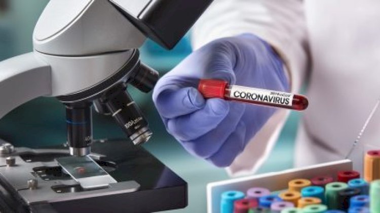    “Bəzən xəstə koronavirus ola-ola test neqativ nəticə göstərə bilər“ - Həkimdən açıqlama   