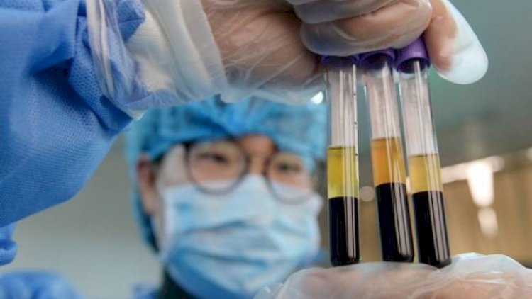    “Koronavirusun əlamətləri olmadan test etdirməyə ehtiyac yoxdur”   - Professor