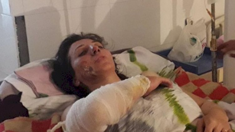    Arvadının üstünə benzib töküb yandırdı - Foto   