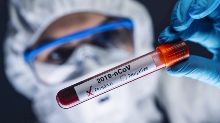    Azərbaycanda daha 105 nəfərdə koronavirus aşkarlandı   