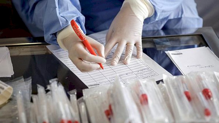    ABŞ-da 2 milyon adam  koronavirus testindən keçib   